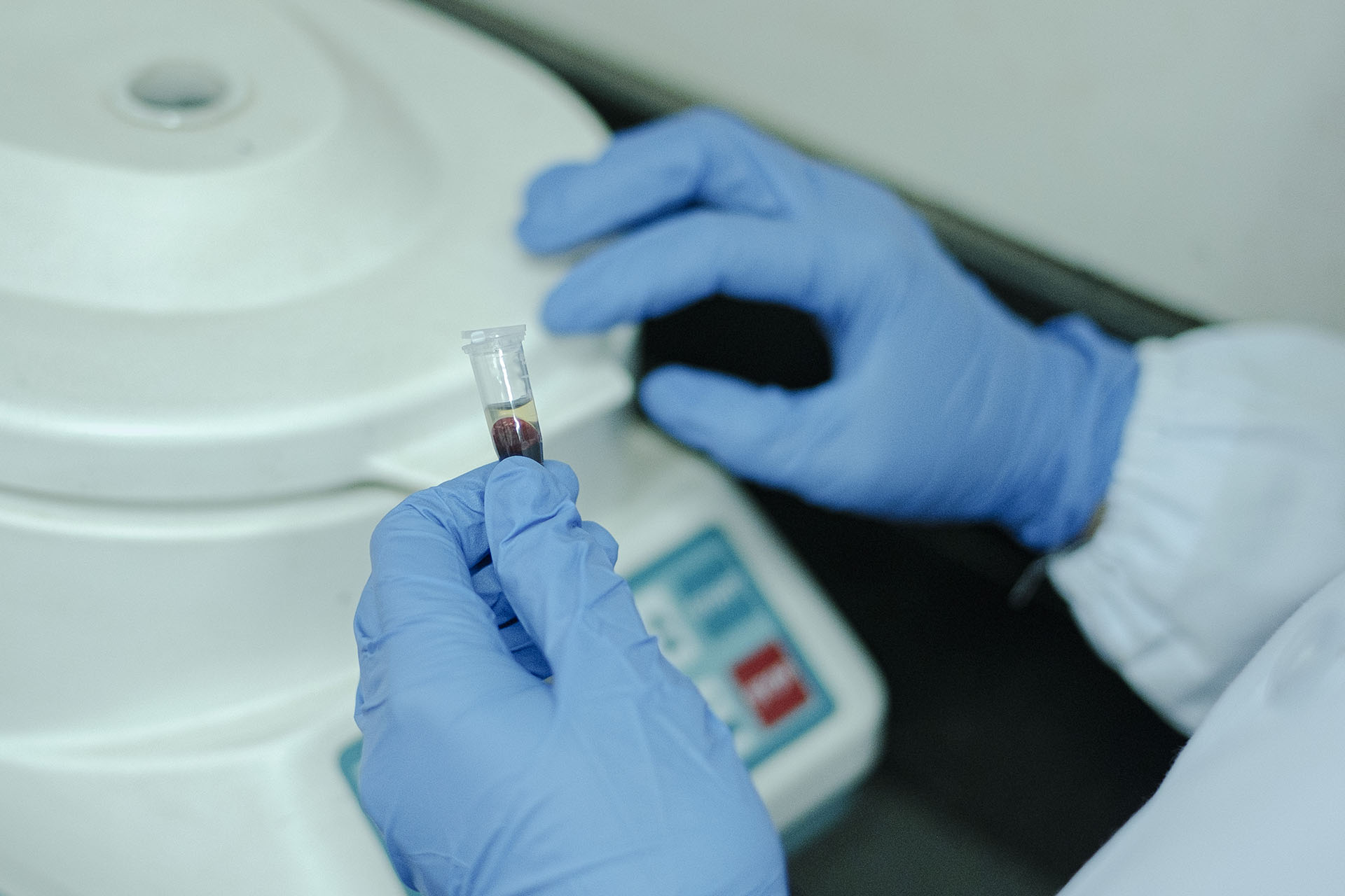 Centrifuging the blood sample for serum separation